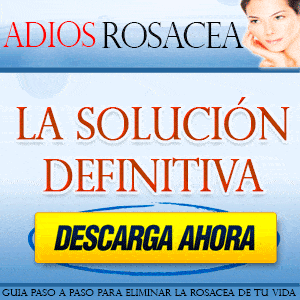 Solución definitiva a la rosacea Solución definitiva a la rosacea