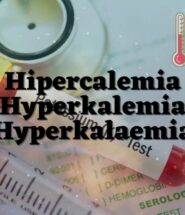 Hipercalemia, Hyperkalemia, Hyperkalemia (o Hiperpotasemia): Exceso de Potasio