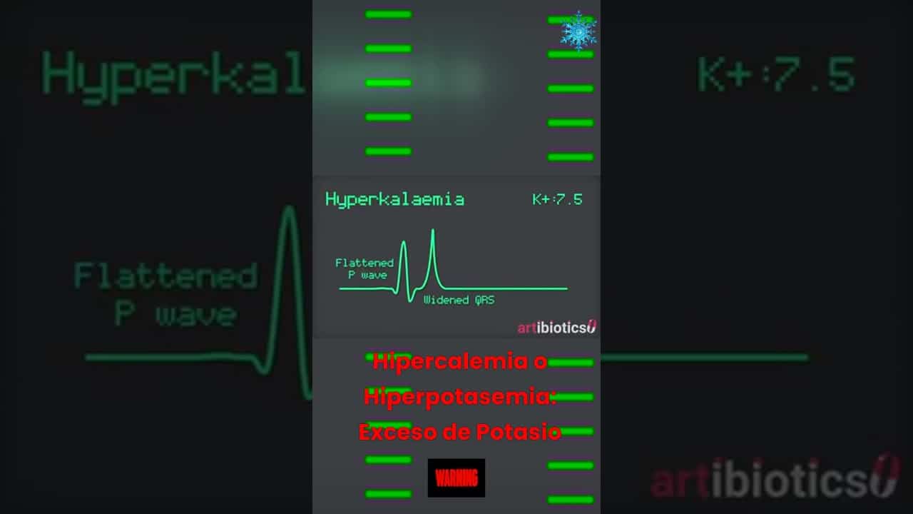 Hipercalemia Short