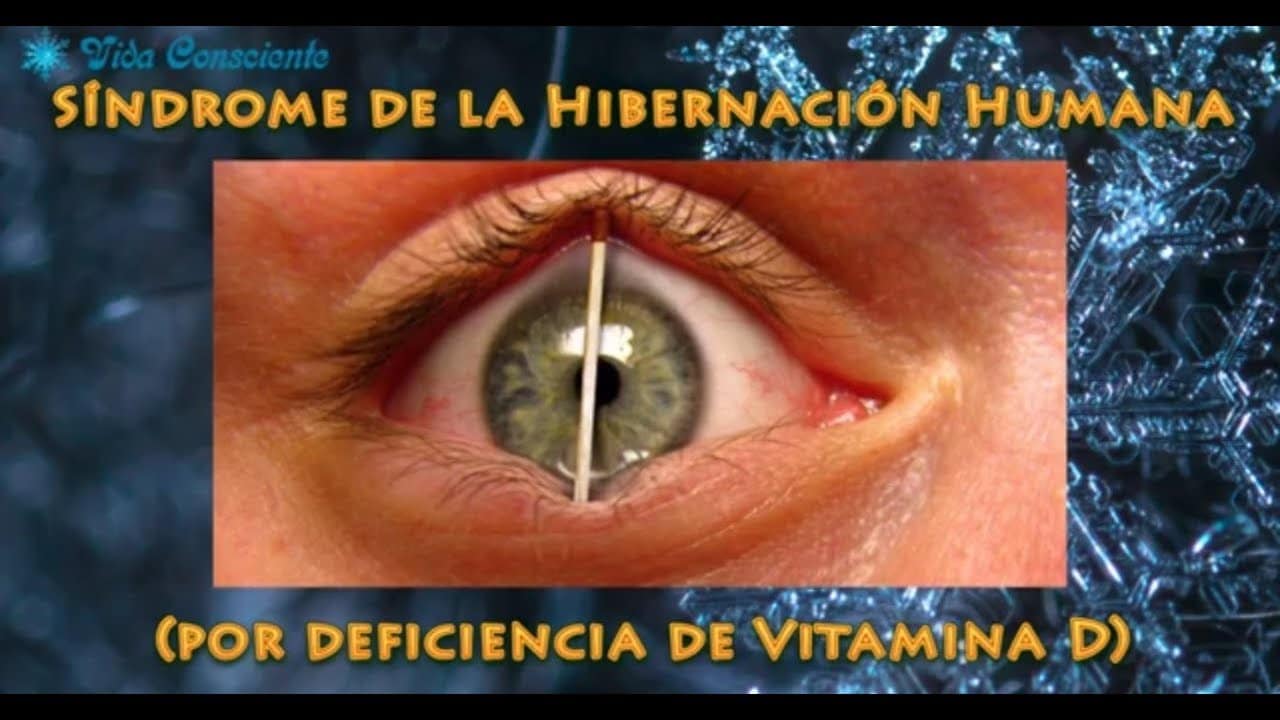 Síndrome de Hibernación Humana (por deficiencia de Vitamina D3)